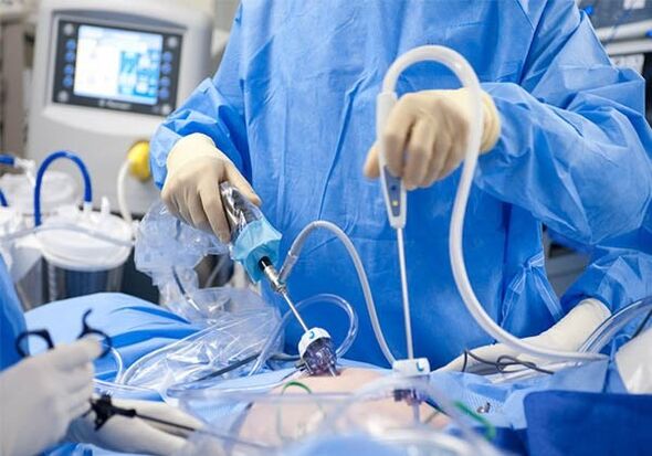 surgical treatment of pelvic varicose veins